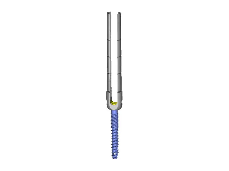 Tornillo pedicular monoaxial de brazo largo